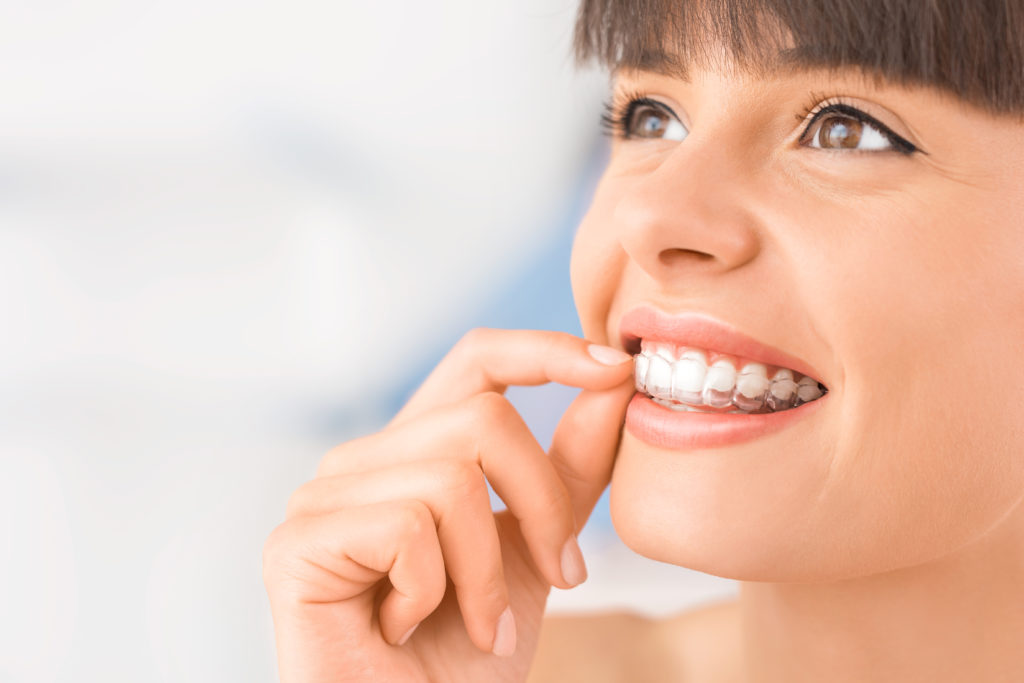 Gouttière dentaire de protection / protège-dents sport sur mesure : prix et  infos au Luxembourg - Orthodontie & Dentiste Luxembourg - Dudelange