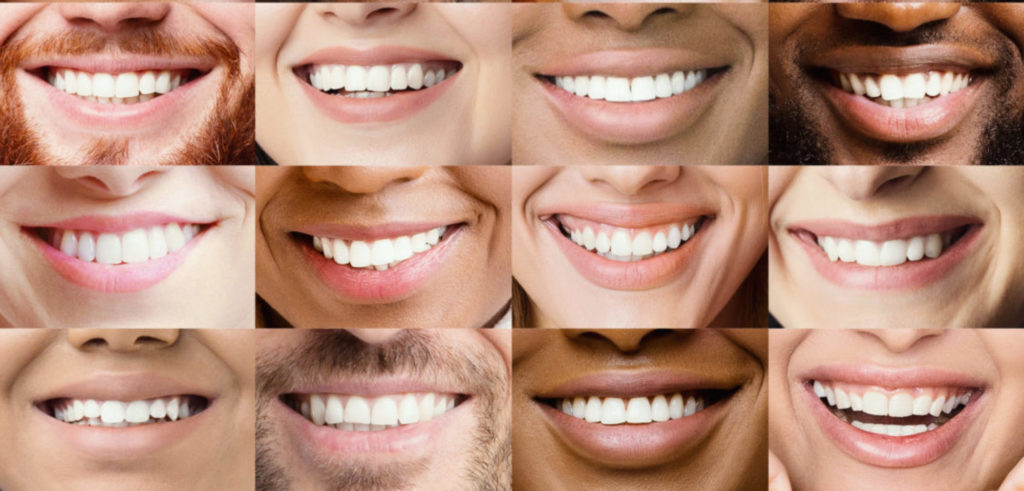 dentaire au LASER au Luxembourg - le prix avoir des dents blanches ? Orthodontie & Dentiste Luxembourg - Dudelange | Cabinet - Tanson