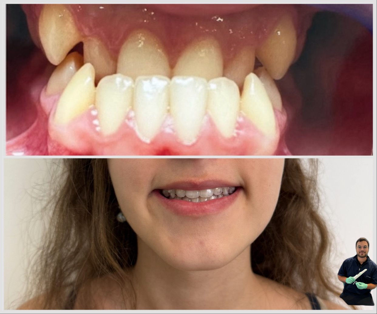 L'orthodontie sans extraction et sans chirurgie, tant que faire se peut.